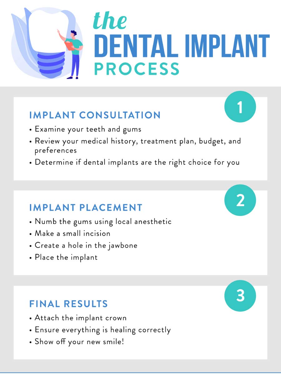 dental implant process